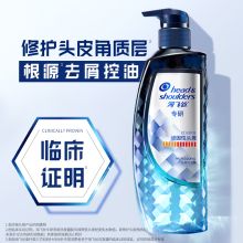 海飞丝 300g 全新王炸定制专研去屑止痒洗发水油性头皮去油洗发水控油无硅（单位：瓶）